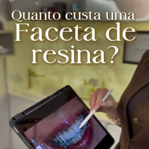 Faceta de resina — Exclusive Odontologia