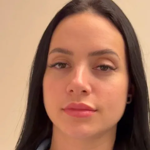 Antes e depois harmonização natural — Exclusive